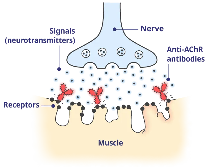 Less muscle damage helps to improve signaling.
